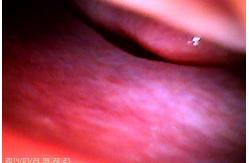 China 2.5mm Android System Digital Fundus Camera 1920x1080 supplier