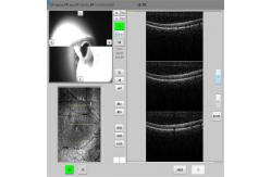 China Raster SD OCT Machine Showing Different Retina Layers supplier