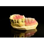 Comfort Fit Durable Complete Acrylic Denture Precision Engineered Material Lightweight Suitable Dental Solutions for sale