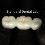 Full Contour High Translucency Solid Zirconia for sale