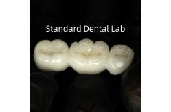 China Full Contour High Translucency Solid Zirconia supplier