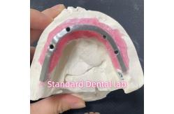 China Esthetic Restoration All On 4 Dental Implants Zirconia Hypo Allergenic supplier