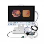 TUYOU Brain Surgery Tool All-In-One Rigid & Flexible Endoscopy Camera System For Uterine Examinations for sale
