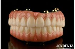 China Natural Teeth And Gums Compatible Ti-Bar Zirconia Hybrid Bridge With High Biocompatibility supplier