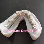 Cast Cobalt Chrome Metal Framework Partial Denture With Metal Frame for sale