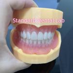 High Esthetic Full Upper And Lower Acrylic Dentures Ivoclar Teeth Pink Gum for sale