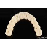 Customizable Ti-Base Zirconia Hybrid Bridge With Excellent Durability And Good Biocompatibility