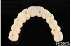 China Customizable Ti-Base Zirconia Hybrid Bridge With Excellent Durability And Good Biocompatibility supplier