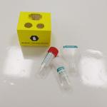 Hospital Genomic DNA Extraction Kit Saliva Preservation For Clinical Experiment for sale