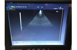 China Medical Ultrasound Scanner Hitachi EUP-S50 Phased Array/Scan Shot supplier