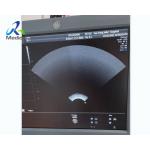 GE Voluson E8 Ultrasound Machine Repair Image Abnormal When Probe Switched