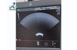 China GE Voluson E8 Ultrasound Machine Repair Image Abnormal When Probe Switched supplier
