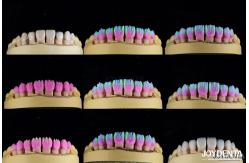 China Advanced Ceramic Porcelain Veneers Biocompatible Shade Matched for a Natural Smile supplier