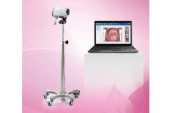 China EDAN C3A&C6A Video Colposcope supplier