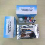 odm Elisa Diagnostic Kit For Hepatitis B Virus Surface Antigen for sale