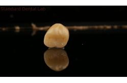 China Mill and Centring Full Zirconia Crown , China Dental Lab Fast Delivery supplier