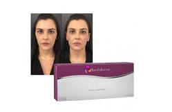 China Juvederm Hyaluronic Acid Dermal Filler Gel for Lips and Cheeks supplier