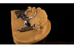 China Metal Alloys Partial Cobalt Chrome Dentures Ivoclar Scheftner Comfortable China Dental Lab supplier