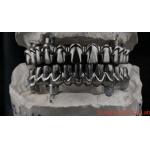 Dental Hybird Malo Implant Bridge Professional Perfect Fit FDA Certified for sale
