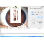 White Iriscope Iridology Camera USB Skin Scanner Diagnosis Analyzer