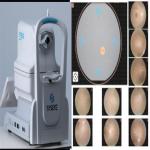 Intelligent Operate Non Mydriatic Wide Field Fundus Camera Automatic Alignment for sale