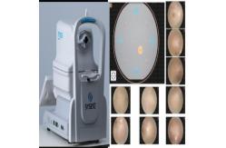 China Intelligent Operate Non Mydriatic Wide Field Fundus Camera Automatic Alignment supplier
