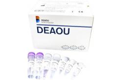 China Lightweight Rapid Test Kit / Diagnostic Test Kits  For Nucleic Acid Detection supplier