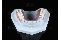 China Lightweight Valplast Flexible Partial With Excellent Retention In Pink And Meharry supplier
