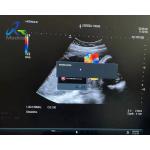 Invalid Ultrasound Machine Repair Hitachi ARIETTA 60 Occasional Hints That Probe Detection for sale