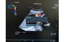 China Invalid Ultrasound Machine Repair Hitachi ARIETTA 60 Occasional Hints That Probe Detection supplier