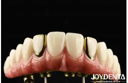 China Experience The Durability Of Titanium Malong Hybrid Bridge For Applicable Dentistry supplier