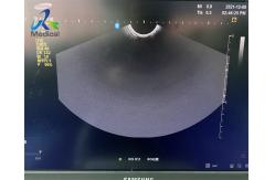 China Samsung EVN4-9 Ultrasound Probe Repair Imaging With Dark Shadows supplier
