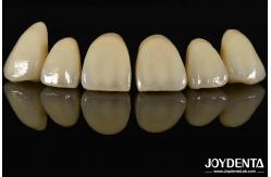 China Bionic Development Leaves And Distinct Layers Of Zirconia All-Ceramic supplier