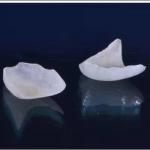 Natural Looking All Porcelain Veneers EMAX Dental Crown for sale