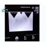 GE Voluson E10 Image Anomaly Ultrasound Machine Repair RFM423 for sale