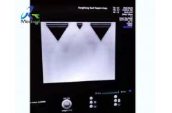 China GE Voluson E10 Image Anomaly Ultrasound Machine Repair RFM423 supplier