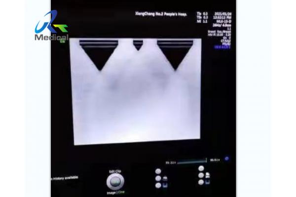 GE Voluson E10 Image Anomaly Ultrasound Machine Repair RFM423