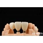 Close Friends Of Bones Foundation Of Beauty Zirconia Implants Aesthetic Assurance for sale
