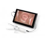 Mini Colposcope for Cervical Examintion Vaginal Camera Connected to TV or PC for sale