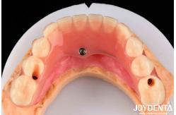 China Natural Looking Acrylic Denture Finish High Biocompatibility With Tooth Arrangement Technology supplier
