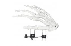 China Orthopedic Surgical Mini Fragment Ilizarov External Fixation Device supplier
