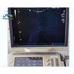 Toshiba Aplio 500 Freeze Images Automatically Ultrasound Repair Service Replace Control Panel for sale
