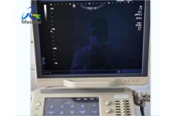 China Toshiba Aplio 500 Freeze Images Automatically Ultrasound Repair Service Replace Control Panel supplier