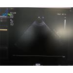  S5-1 Linear Array Ultrasound Transducer Probe Crystal Array Replacement