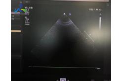 China  S5-1 Linear Array Ultrasound Transducer Probe Crystal Array Replacement supplier