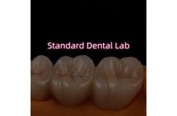 China High Translucent PFZ Layered Zirconia Bridge Porcelain Ceramic Posterior supplier