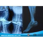 Radiology Blue Inkjet Medical X - ray Film Waterproof Inkjet Printing Film