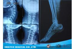 China Radiology Blue Inkjet Medical X - ray Film Waterproof Inkjet Printing Film supplier