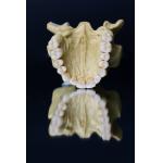 Dental Lab Porcelain Zirconia Dental Crown 5 Stars Esthetics for sale
