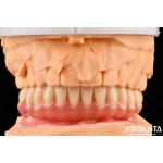 Natural Looking Acrylic Denture Finish High Biocompatibility With Tooth Arrangement Technology for sale